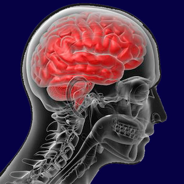 WIAA Concussion Insurance Enters Third Year